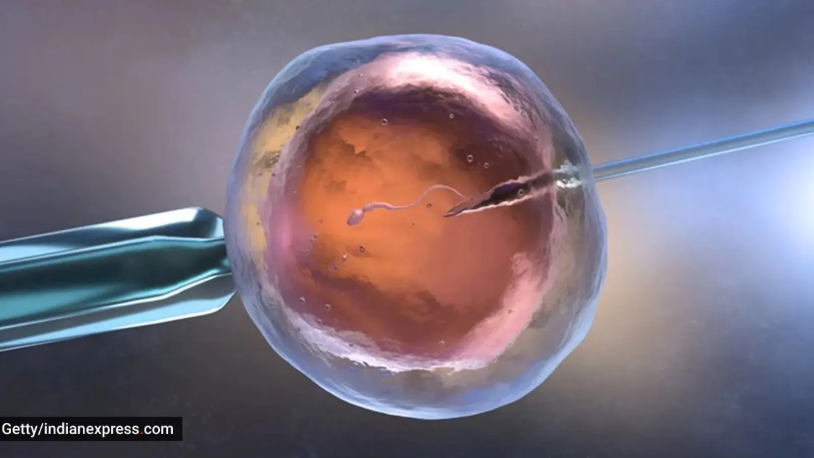IVF After 50: Why Gujarat couples are fighting age cutoff and what a top doctor says