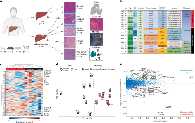 A spatial atlas of the healthy human liver from live donors - Nature