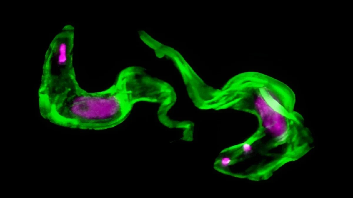 Scientists Solve 40-Year-Old Mystery of Sleeping Sickness Parasite - ScienceAlert